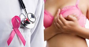 Nepotrebna svaka treća operacija raka na dojkama