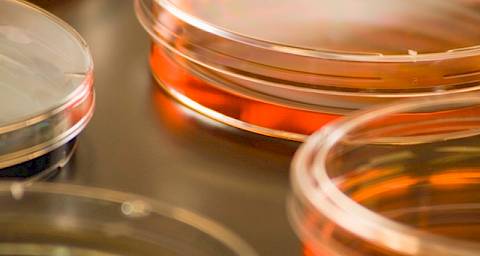 U Hrvatskoj oko 600 HIV pozitivnih