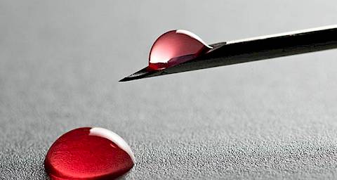 Krvni test za otkrivanje Downovog sindroma