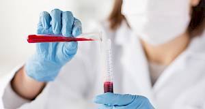 Urea nitrat u krvi – BUN test